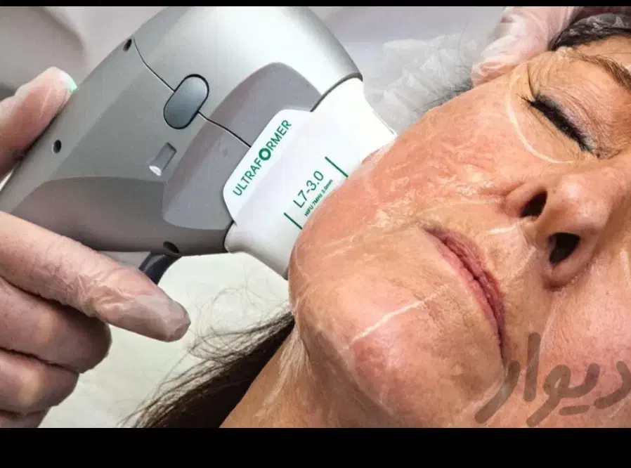 جوان کردن صورت در یک جلسه هایفو تراپی با ۸۵۰هزار ت|خدمات آرایشگری و زیبایی|اصفهان, احمدآباد|دیوار