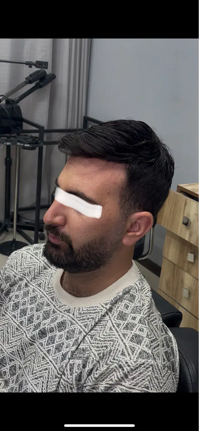 پروتز مو|آرایشی، بهداشتی، درمانی|تهران, نارمک|دیوار