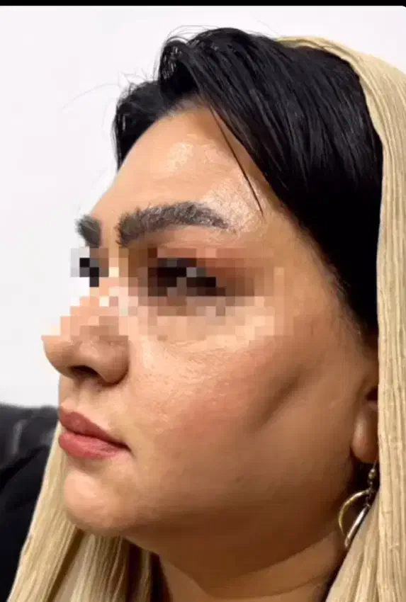 جشنواره لاغری 3تا12سانت در1جلسه وهایفوتراپی vip|خدمات آرایشگری و زیبایی|رشت, پارک شهر|دیوار