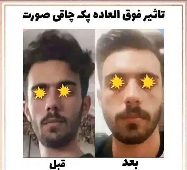 بمب چاقی صورت (جوانه گندم)|حراج|کرمان, |دیوار