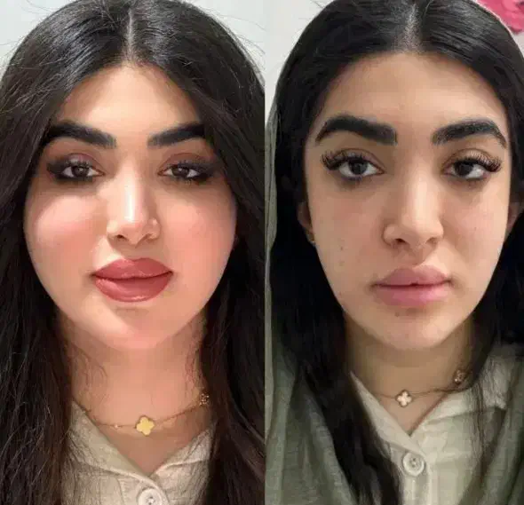 مرکز زیبایی بوتاکس و فیلر و تمامی خدمات زیبایی|خدمات آرایشگری و زیبایی|اصفهان, ملکشهر|دیوار