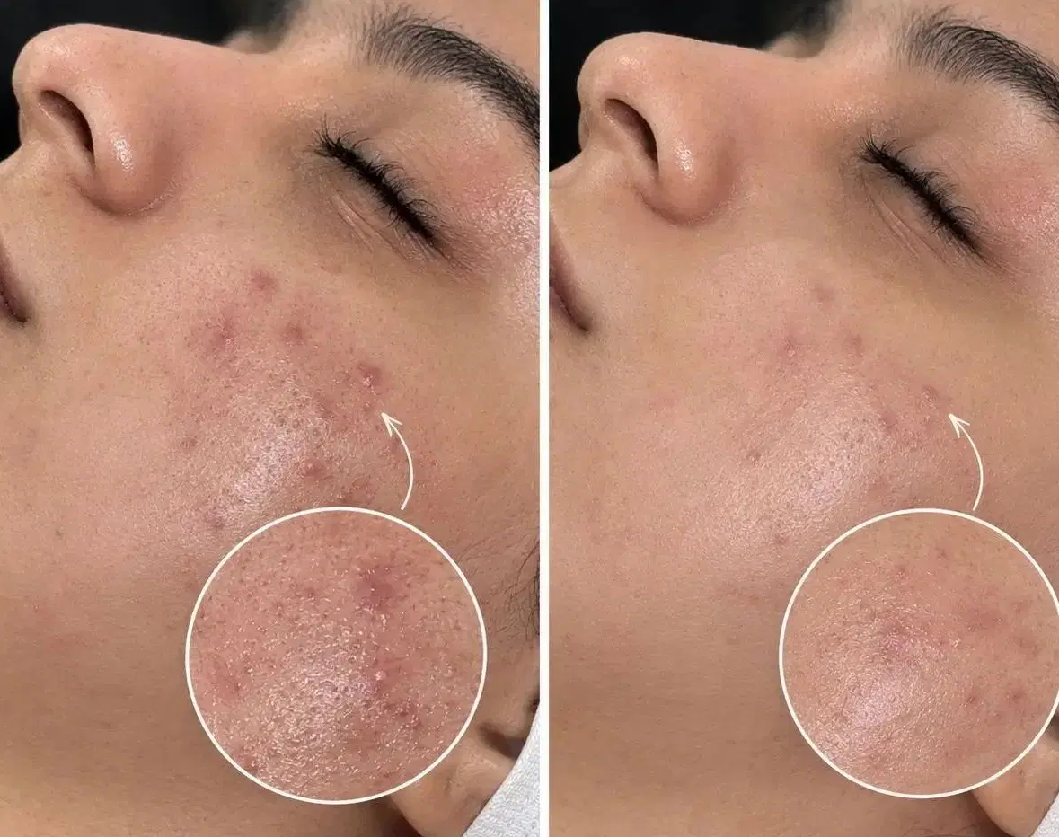 فیشال آقایانو بانوان تنظیف وعنایةاحترافیة بالبشرة|خدمات زیبایی و سلامت|مشهد, احمدآباد|دیوار