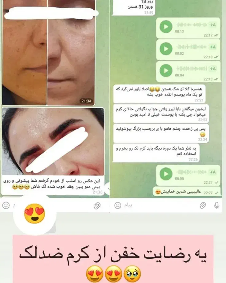 ضدلک لاکچری کوین بدون بازگشت بدون کورتون تضمینی|آرایشی، بهداشتی، درمانی|یاسوج, |دیوار