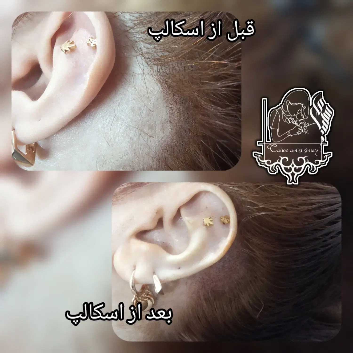 میکرو اسکالپ سر|خدمات آرایشگری و زیبایی|شیراز, اصلاح‌نژاد|دیوار