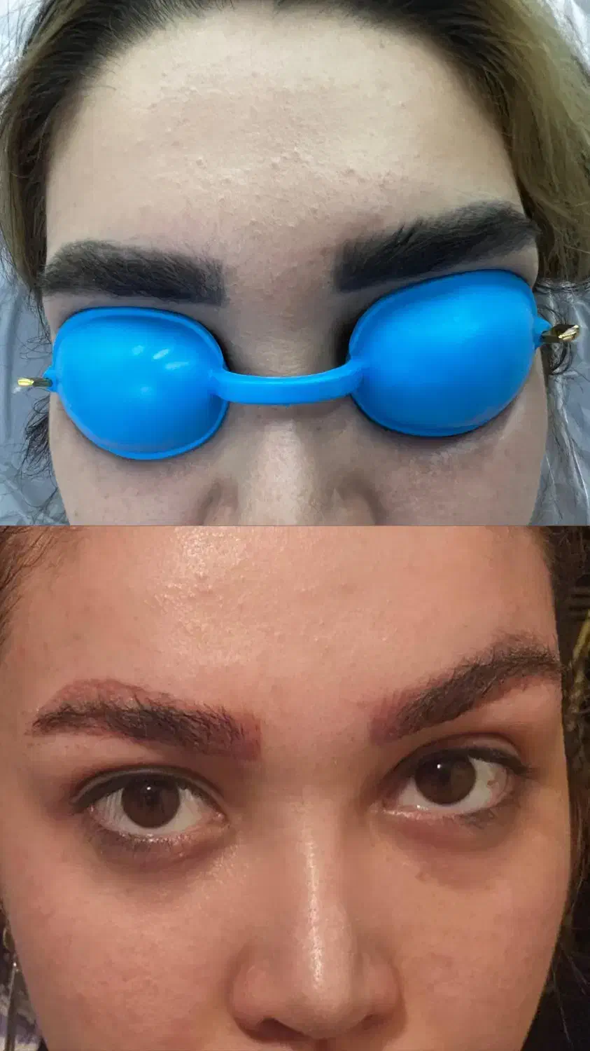 لیزر تتو وروشن کننده بدن|خدمات آرایشگری و زیبایی|پاکدشت, پاکدشت (مامازند)|دیوار