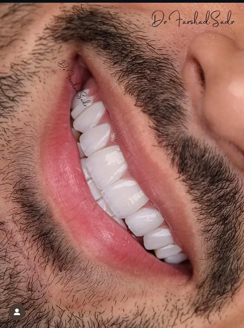 لابراتوار دندانسازی|استخدام درمانی، زیبایی، بهداشتی|تبریز, |دیوار