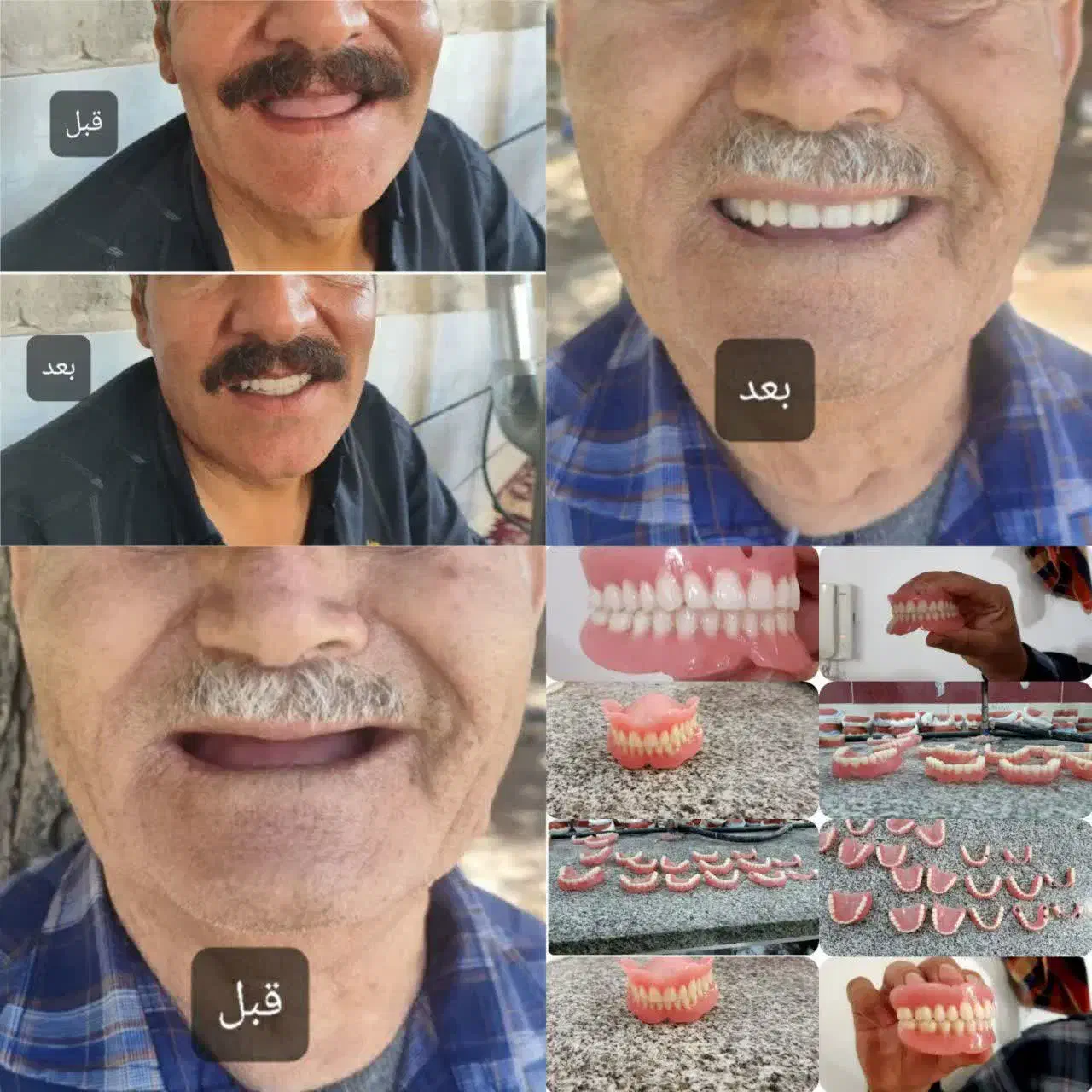 ساخت دندان مصنوعی کامل و تکه ای ضمانتی|آرایشی، بهداشتی، درمانی|مرودشت, بیست متری بیمارستان|دیوار