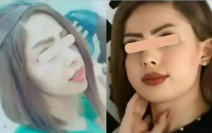 پرکننده صورت فرانسوی ۱۵روزه بدون کورتون و عوارض|آرایشی، بهداشتی، درمانی|اهواز, باغ شیخ|دیوار