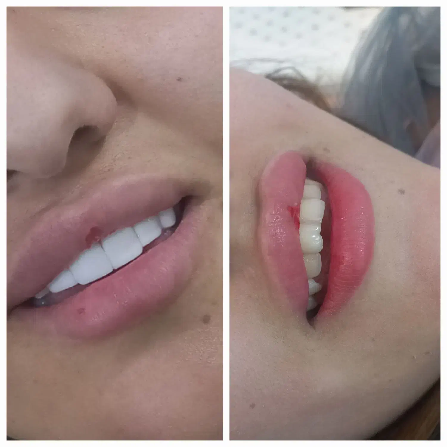 کامپوزیت دندان با بهترین کفیت با قیمتی مناسب|خدمات آرایشگری و زیبایی|یاسوج, |دیوار