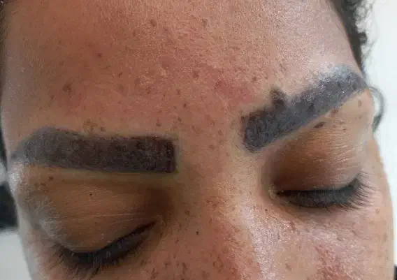 آموزش ریموو تاتو|خدمات آموزشی|گرگان, |دیوار