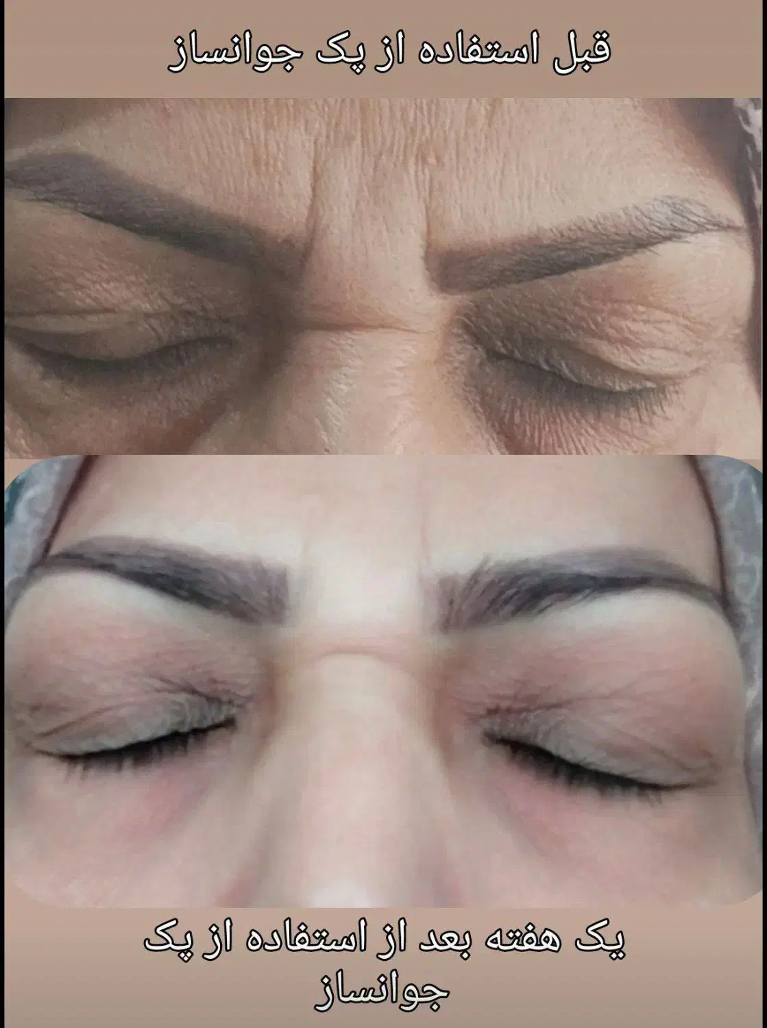 سرم جوانساز سلولهای بنیادی گل رز|آرایشی، بهداشتی، درمانی|شاهین‌شهر, امام حسین|دیوار