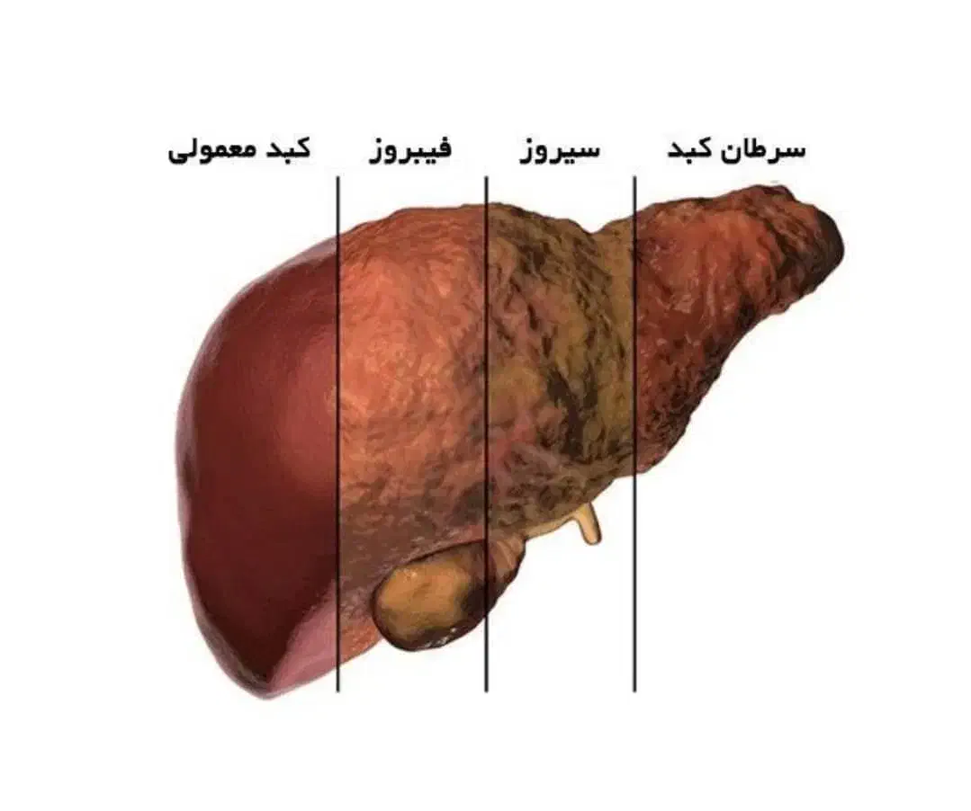 کبد پاک|آرایشی، بهداشتی، درمانی|اردبیل, |دیوار