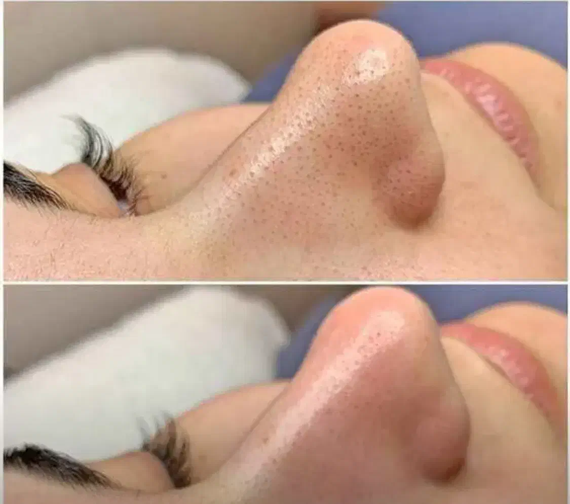 فیشیال پاکسازی|خدمات آرایشگری و زیبایی|چغادک, |دیوار