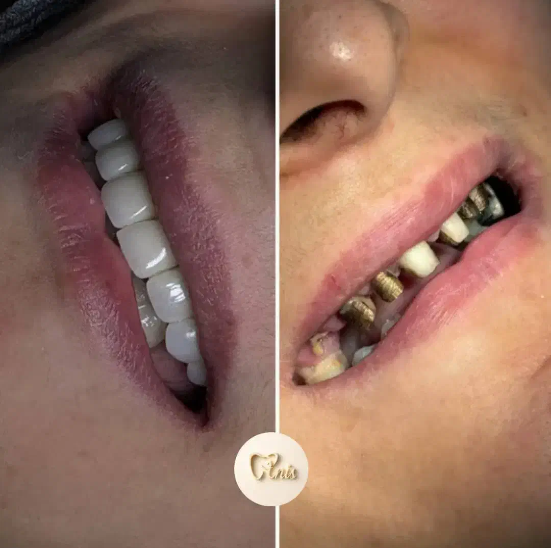 دندان پزشکی|خدمات آرایشگری و زیبایی|قم, نوقطار|دیوار