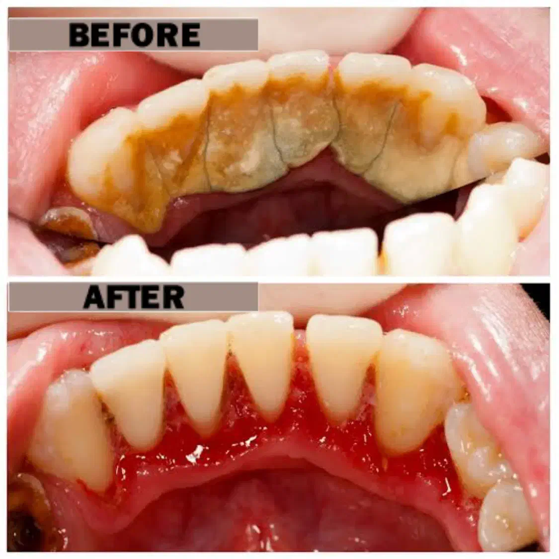 خدمات دندانپزشکی تاکستان ( آفر ویژه )|خدمات آرایشگری و زیبایی|تاکستان, |دیوار