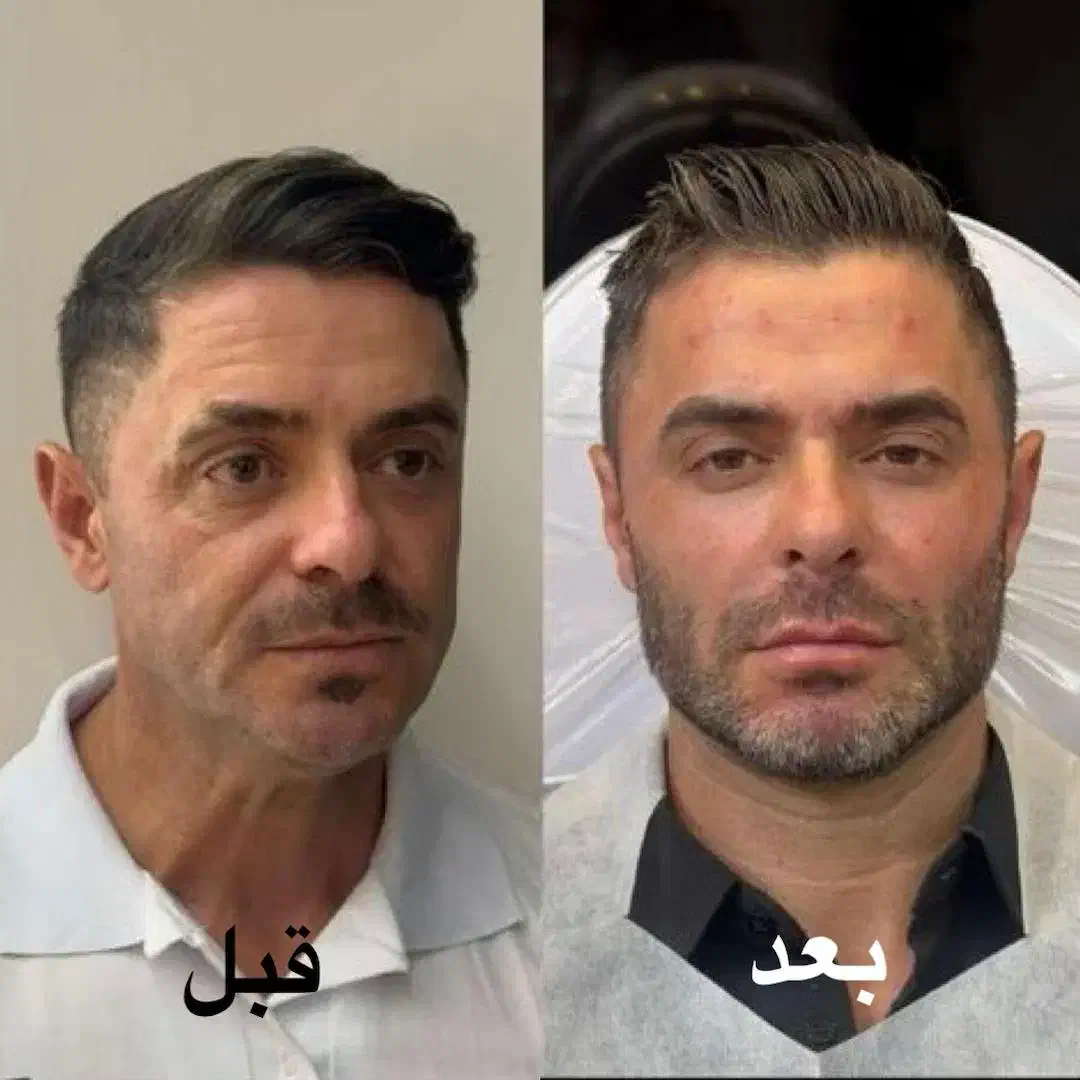 انجام خدمات ژل و بوتاکس و تمامی جراحی ها|خدمات آرایشگری و زیبایی|شهریار, شهریار|دیوار