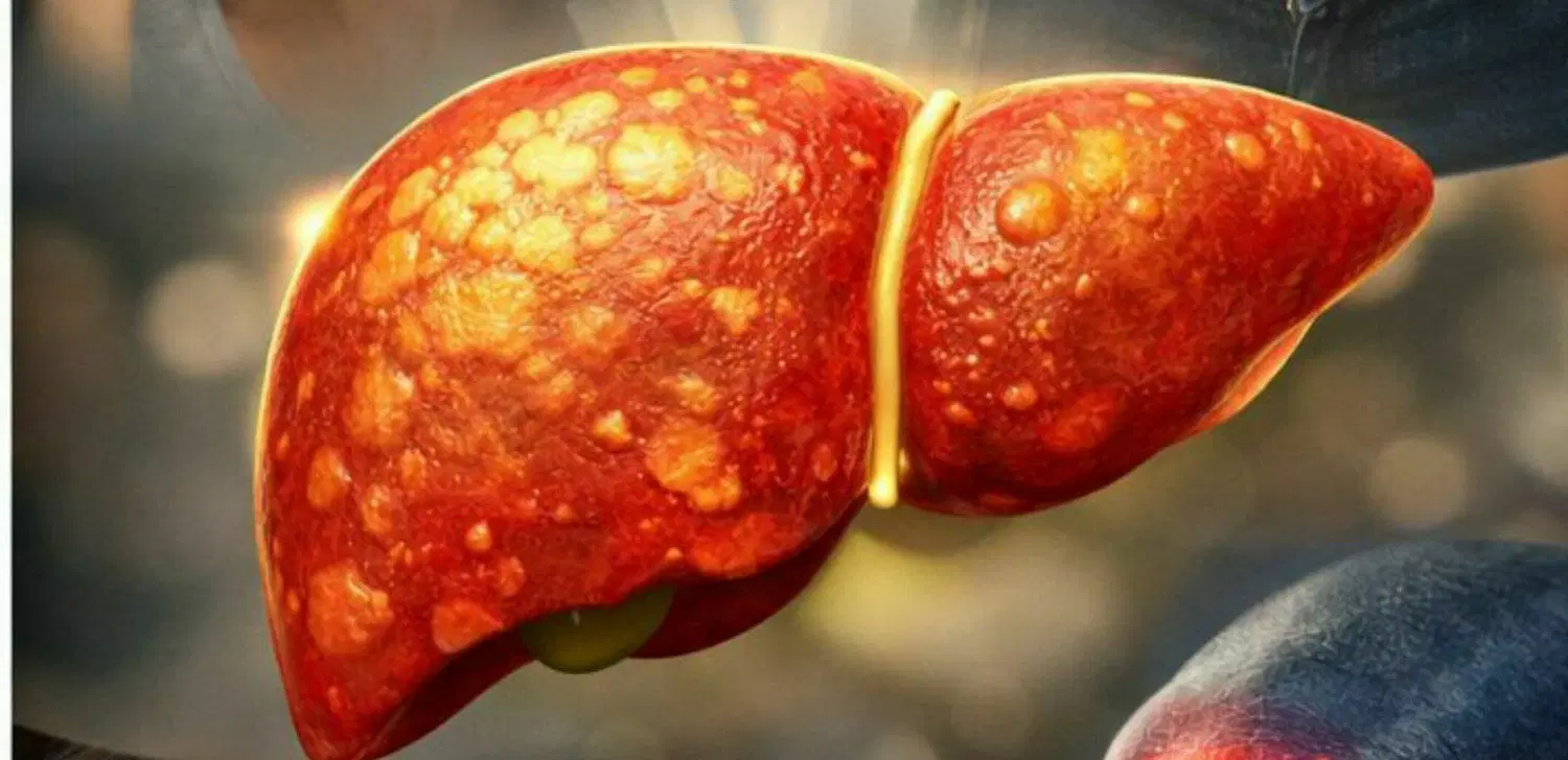 طب سنتی|پزشکی|شیراز, سیاه سنگ|دیوار