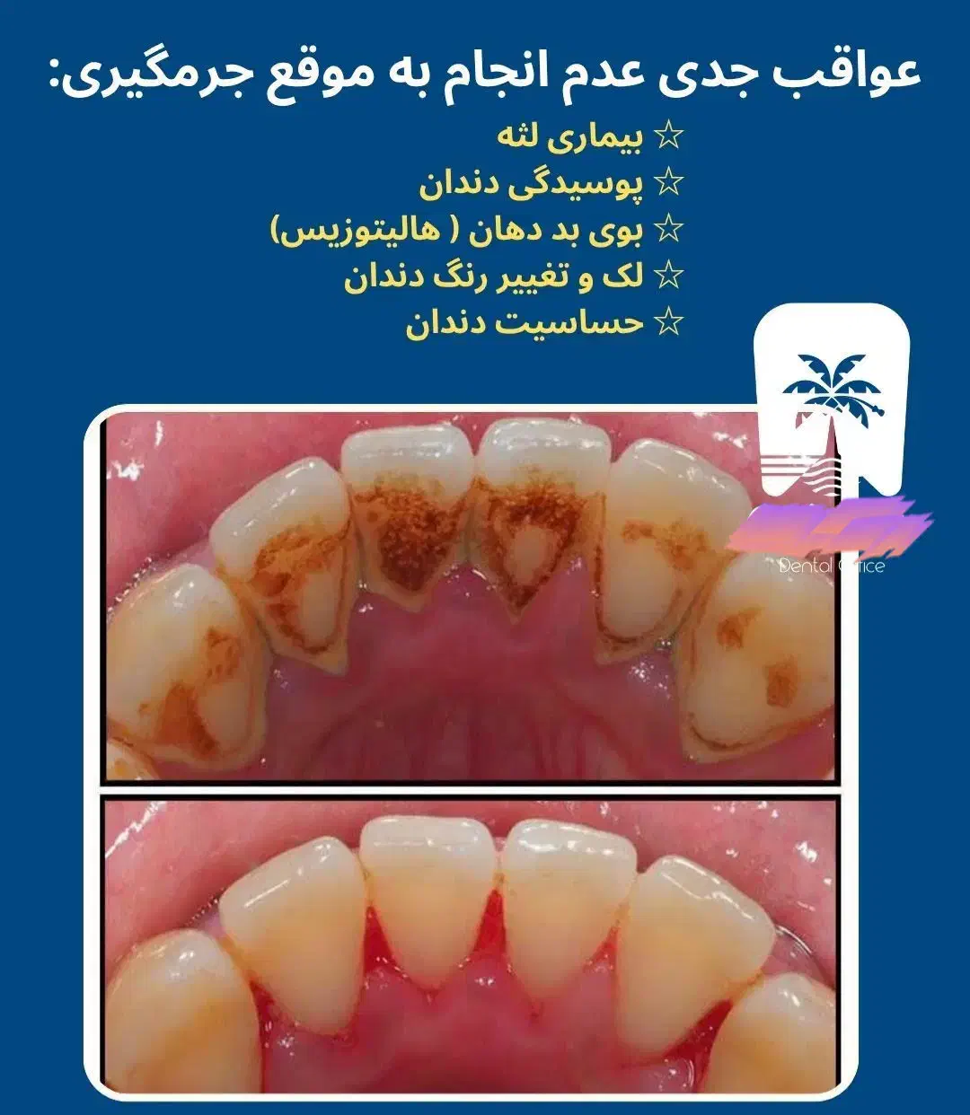 انجام جرمگیری هر فک فقط ۴۵۰ تومان در مطب شخصی|خدمات آرایشگری و زیبایی|زاهدان, |دیوار
