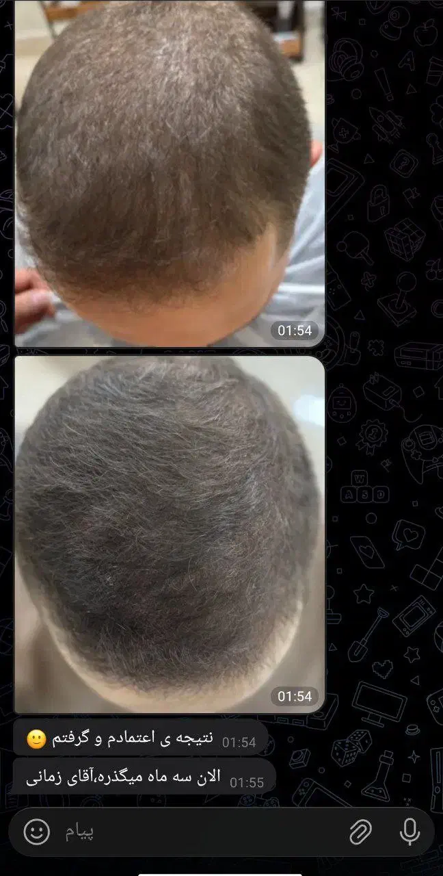 قطع ریزش در دوهفته|آرایشی، بهداشتی، درمانی|خوسف, |دیوار