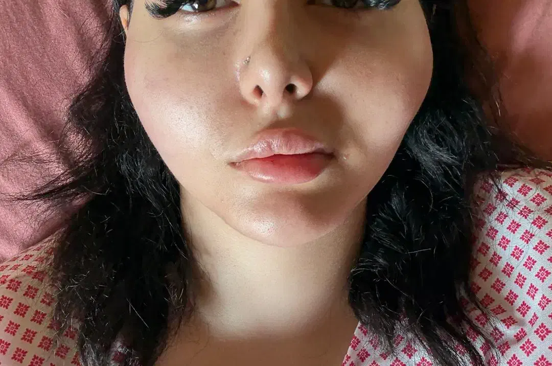 آموزش وخدمات ژلوبوتاکس.پرسینگ.حجامت.زالو.پرستاری|خدمات آرایشگری و زیبایی|پرند, فاز ۲|دیوار