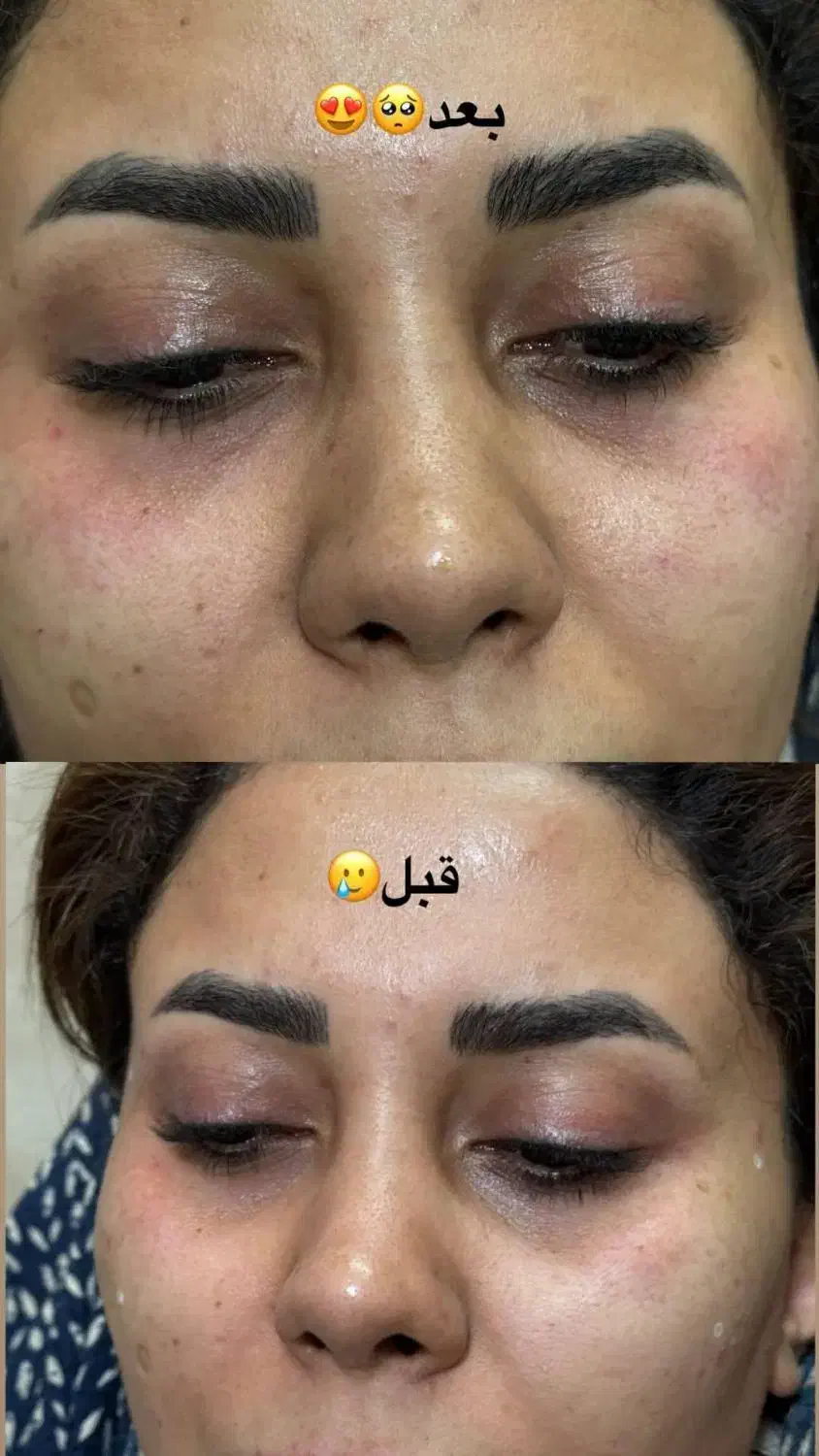 مطب زیبایی در کرمان با ضمانت صد در صد بوتاکس|خدمات آرایشگری و زیبایی|کرمان, |دیوار