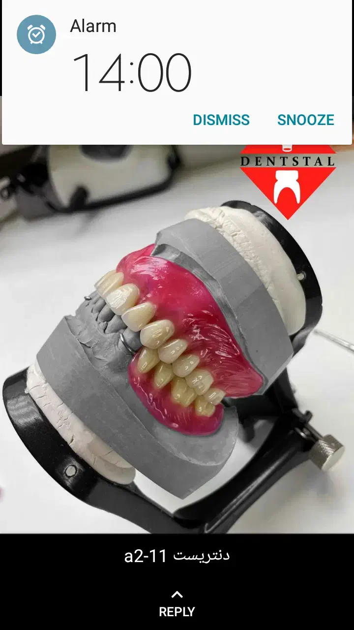 ساخت دندان مصنوعی باضمانت دندانسازی تضمینی|خدمات آرایشگری و زیبایی|کرج, چمران|دیوار