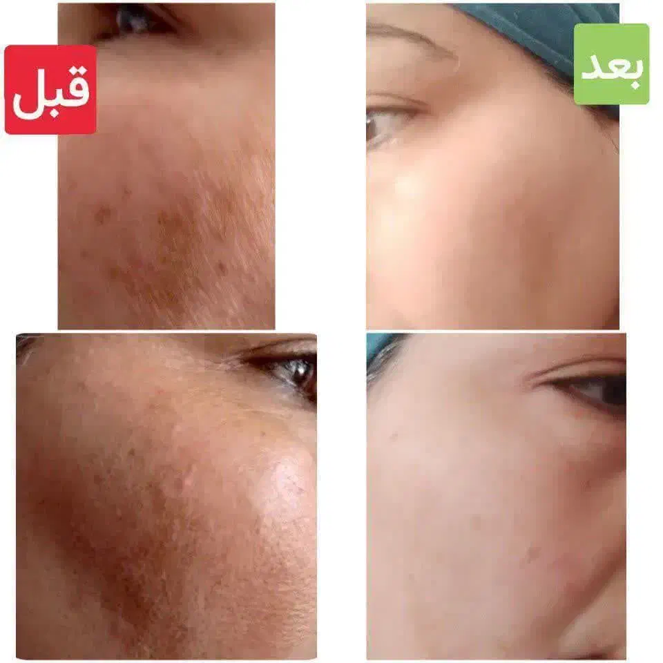 محصولات گیاهی درمانی|آرایشی، بهداشتی، درمانی|نیریز, |دیوار