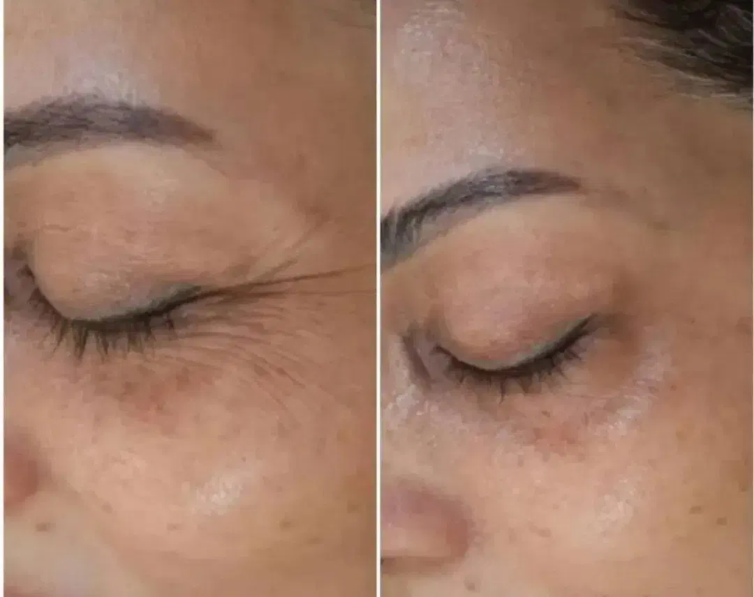 پوست کره ای|خدمات آرایشگری و زیبایی|ارومیه, |دیوار