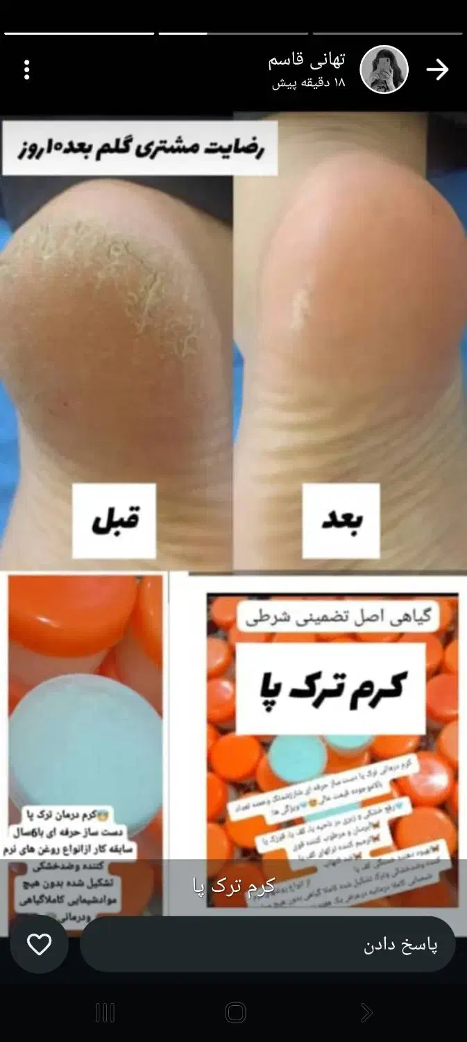 خوراکی|آرایشی، بهداشتی، درمانی|اهواز, کوی رمضان|دیوار