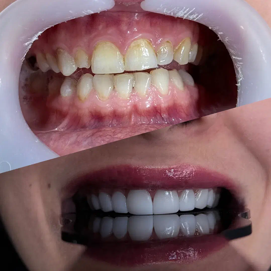 کامپوزیت دندان با برندهای معتبر جهانی|خدمات آرایشگری و زیبایی|اهواز, نادری|دیوار