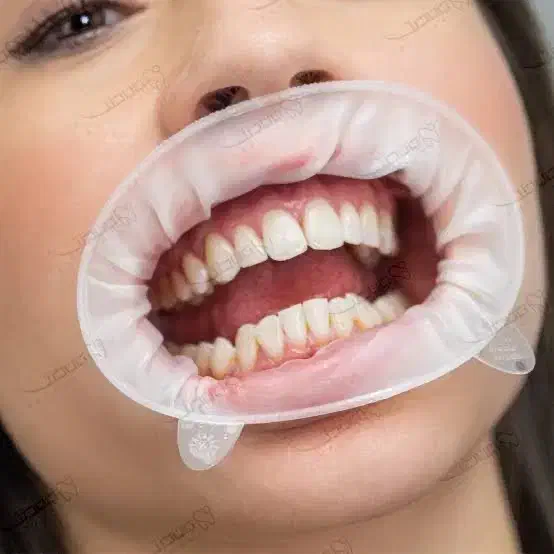 دستیار حرفه ای دندانپزشکی|استخدام درمانی، زیبایی، بهداشتی|نیریز, |دیوار