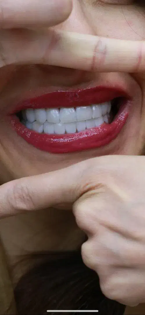 کامپوزیت،لمینیت اقساط 2 تا 12 ماهه|خدمات آرایشگری و زیبایی|بومهن, |دیوار