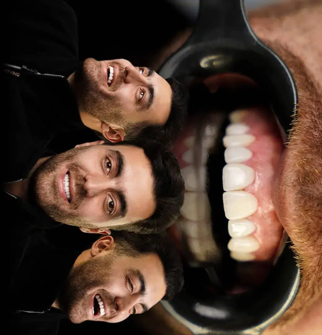 جشنواره کامپوزیت واحدی 1500ت با طرح طلابی شو|خدمات آرایشگری و زیبایی|گرگان, |دیوار