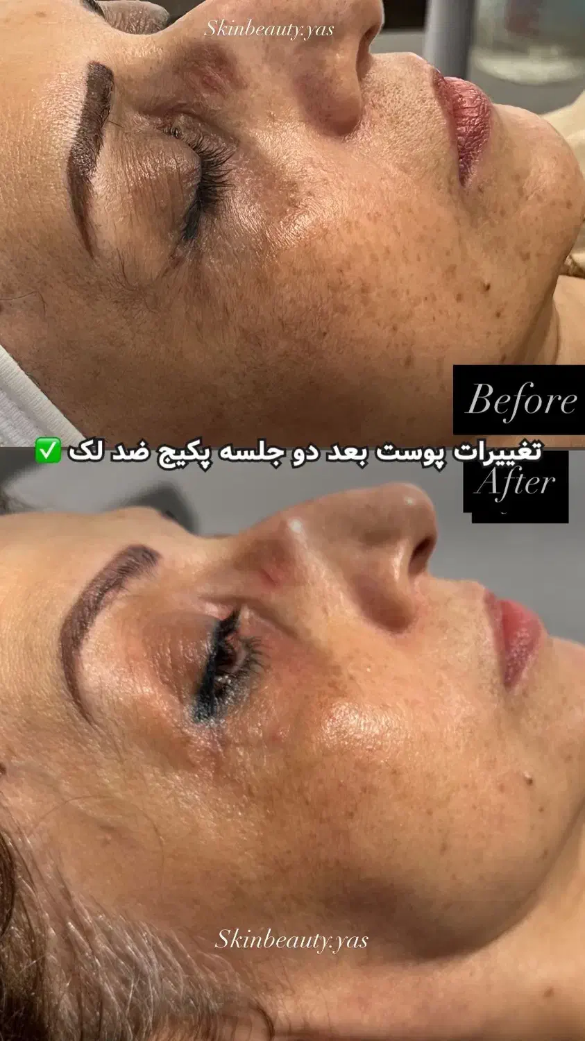 مدل فیشال صورت بدن خانم اقا دونفره یا تک نفره|خدمات آرایشگری و زیبایی|مشهد, وکیل‌آباد|دیوار