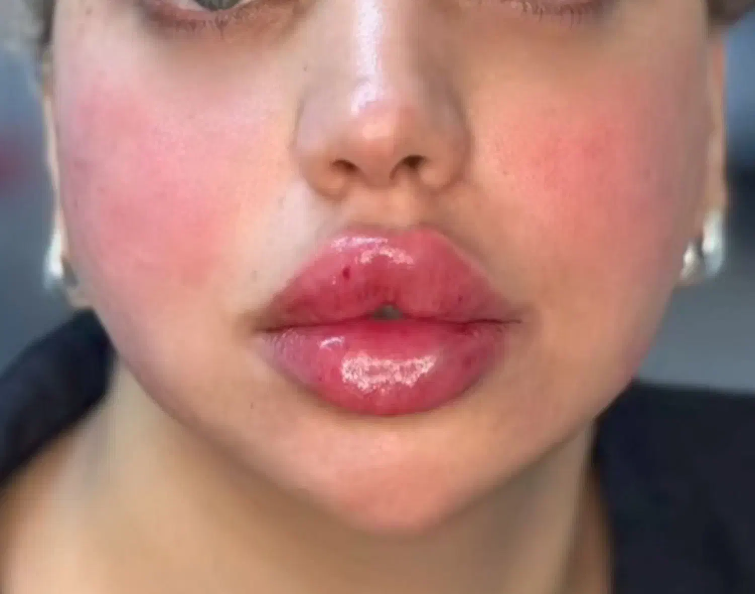 آف ژل وبوتاکس|خدمات آرایشگری و زیبایی|مسجد سلیمان, |دیوار