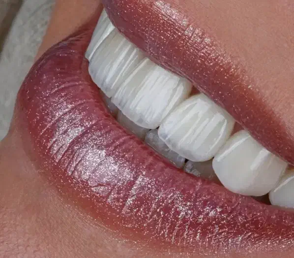 شرایط ویژه جشنواره دندانپزشکی ایمپلنت و اوردنچر|خدمات آرایشگری و زیبایی|آذرشهر, |دیوار