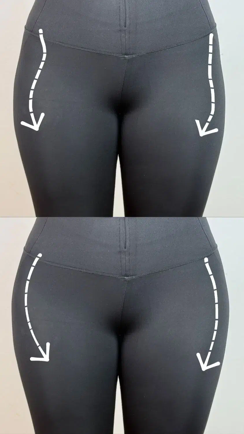 فیلربادی با تخفیف ۵۰٪در کلینیک مهرزاد|خدمات آرایشگری و زیبایی|تهران, جردن|دیوار