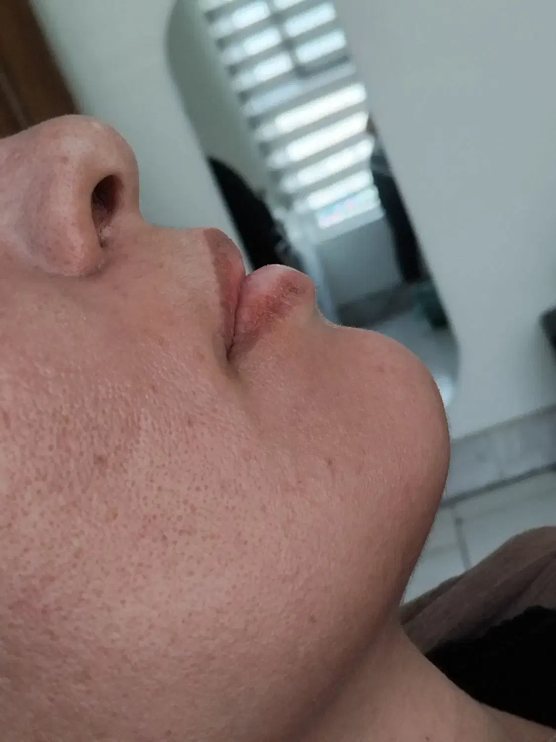 اموزش ژل بوتاکس و تمام خدمات مزو تراپی|خدمات آموزشی|مشهد, چهارچشمه|دیوار