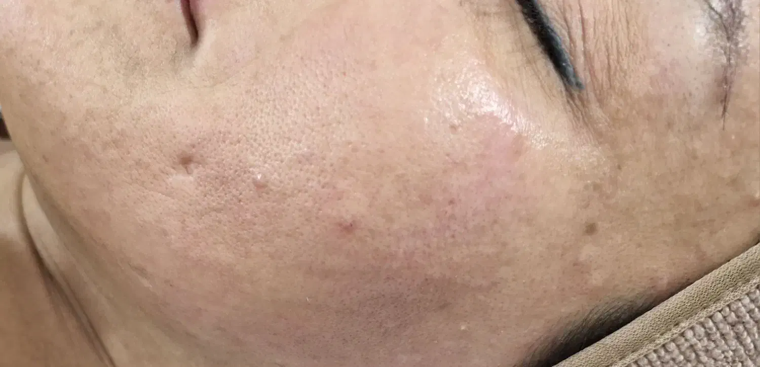 فیشال درمانی تخصصی|خدمات آرایشگری و زیبایی|بندر ماهشهر, |دیوار