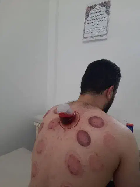 حجامت|خدمات آرایشگری و زیبایی|قرچک, مهدیه|دیوار