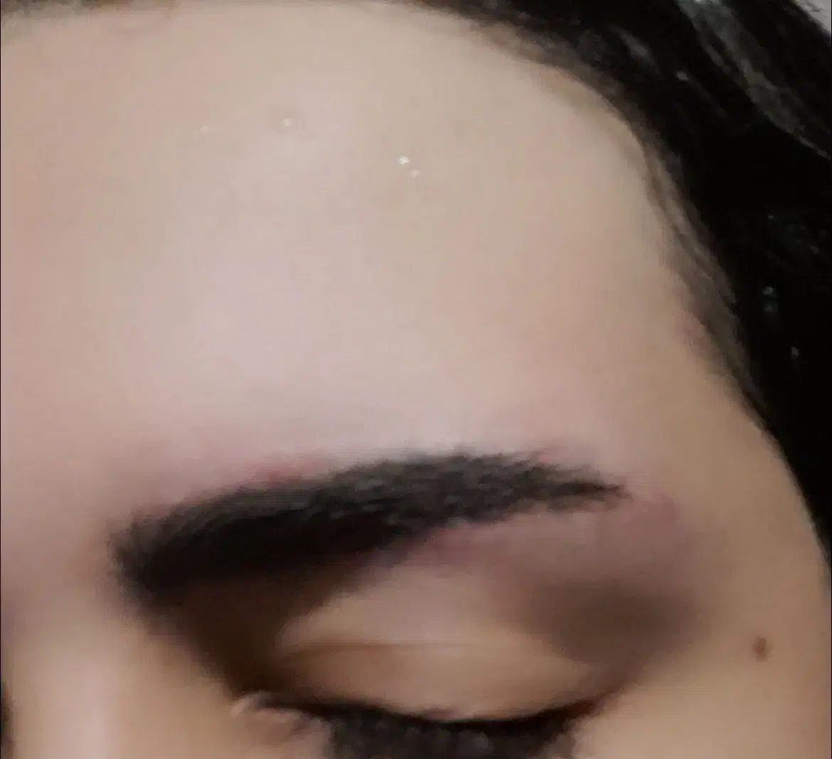 لیزر پاک کردن تاتو بدن و صورت|خدمات آرایشگری و زیبایی|محمدشهر, محمدشهر|دیوار