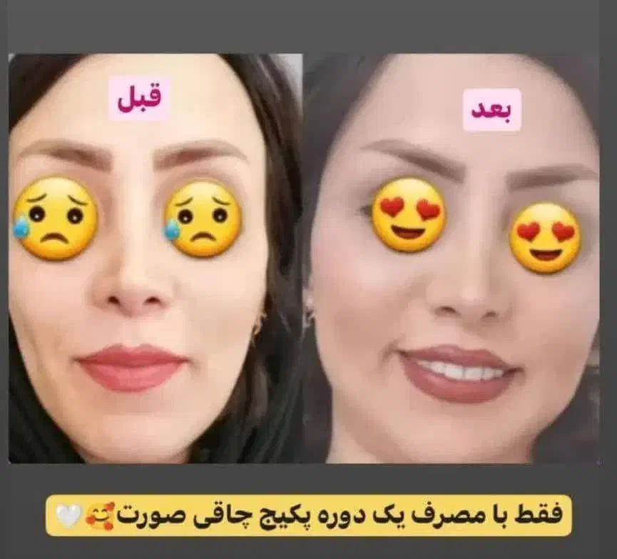 چاقی صورت به روش طبیعی|خوردنی و آشامیدنی|خاش, |دیوار