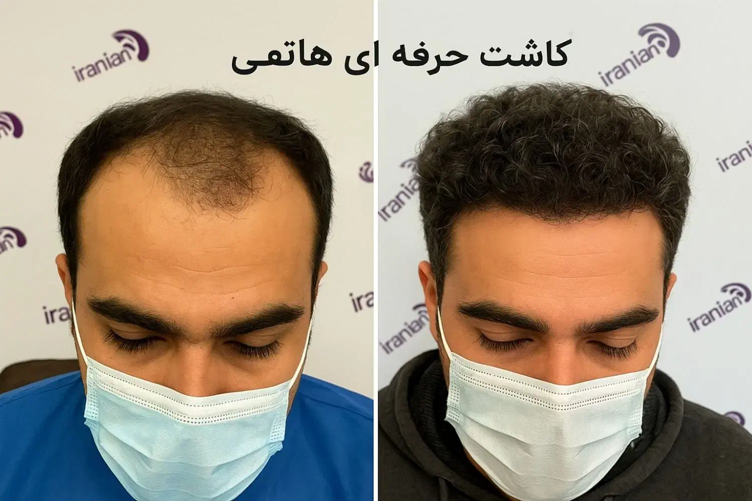 کلینیک تخصصی کاشت|خدمات آرایشگری و زیبایی|پیرانشهر, |دیوار