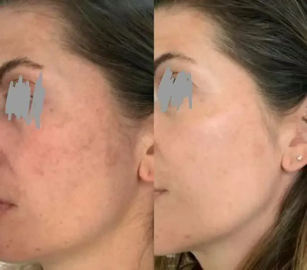 لکه برِ جهانی|آرایشی، بهداشتی، درمانی|کبودرآهنگ, |دیوار