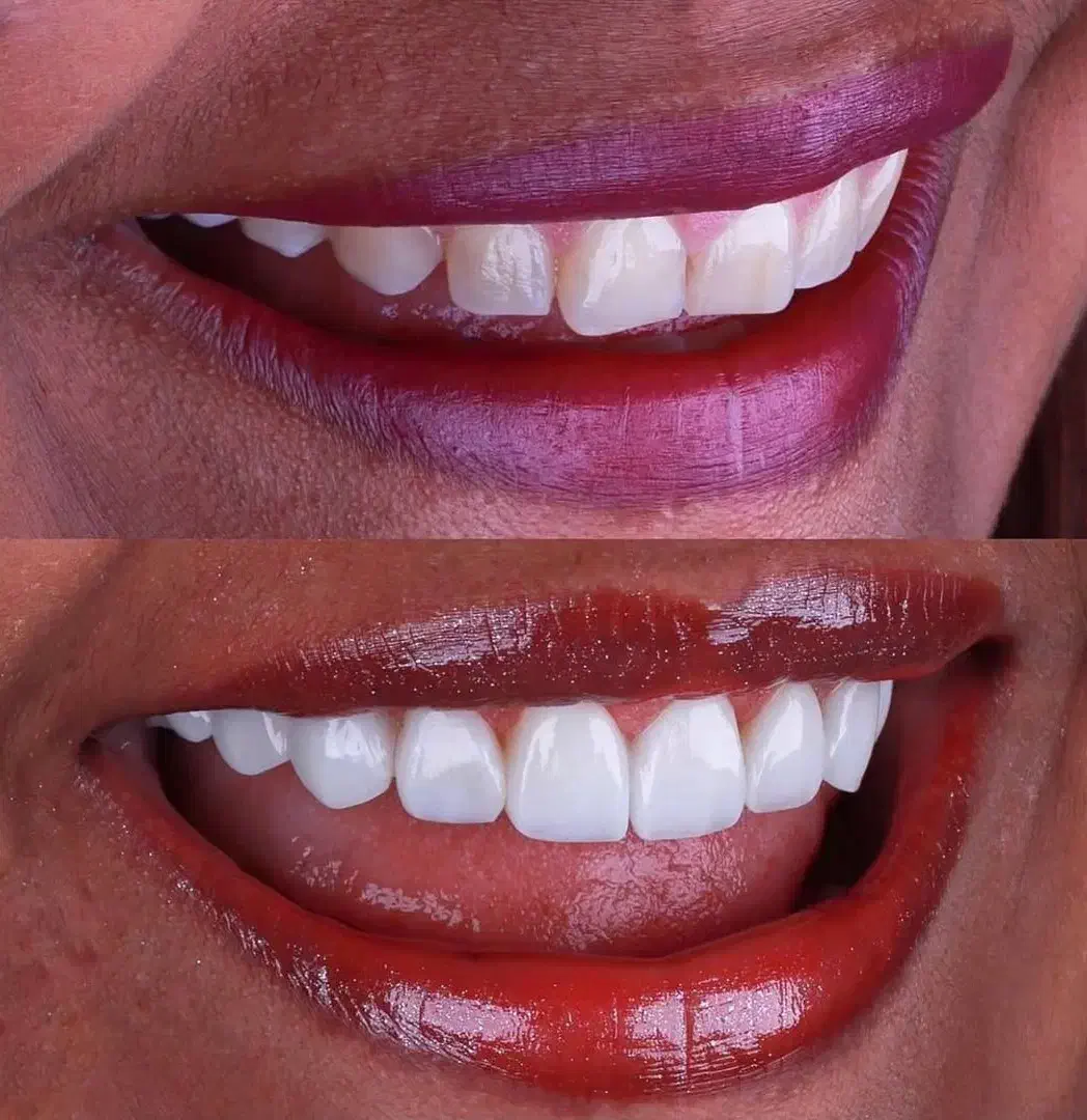 تخفیف‌های ویژه دندانپزشکی عکس تمام فک رایگان|خدمات آرایشگری و زیبایی|فردیس, شهرک هفده شهریور|دیوار