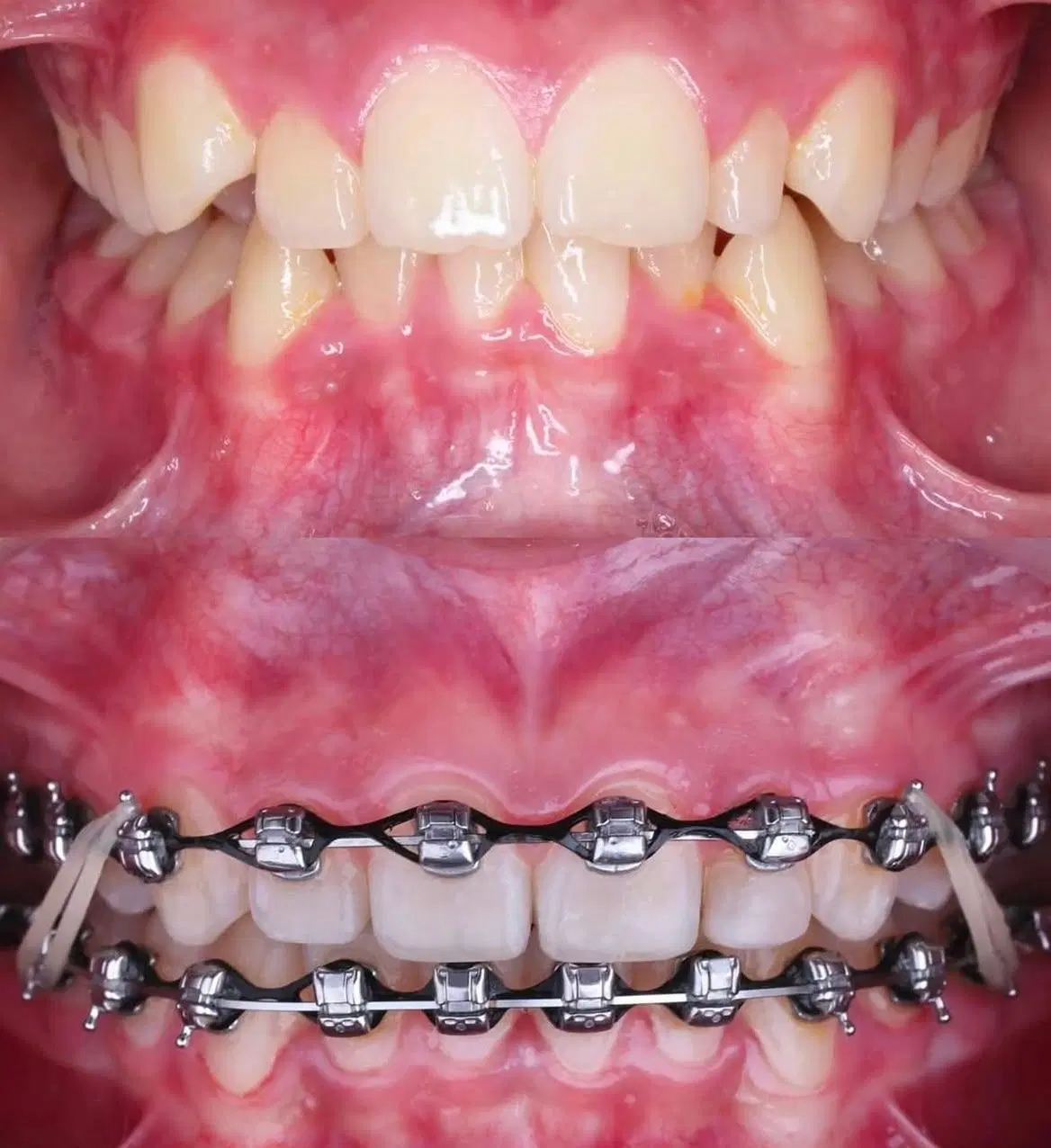 ارتودنسی از دم قسط، هرفک 55 میلیون (فقط تا 1 هفته)|خدمات زیبایی و سلامت|تهران, دروس|دیوار
