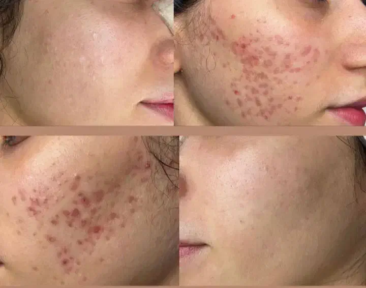 جشنواره مطب زیبایی ماهورا|خدمات آرایشگری و زیبایی|قروه, |دیوار