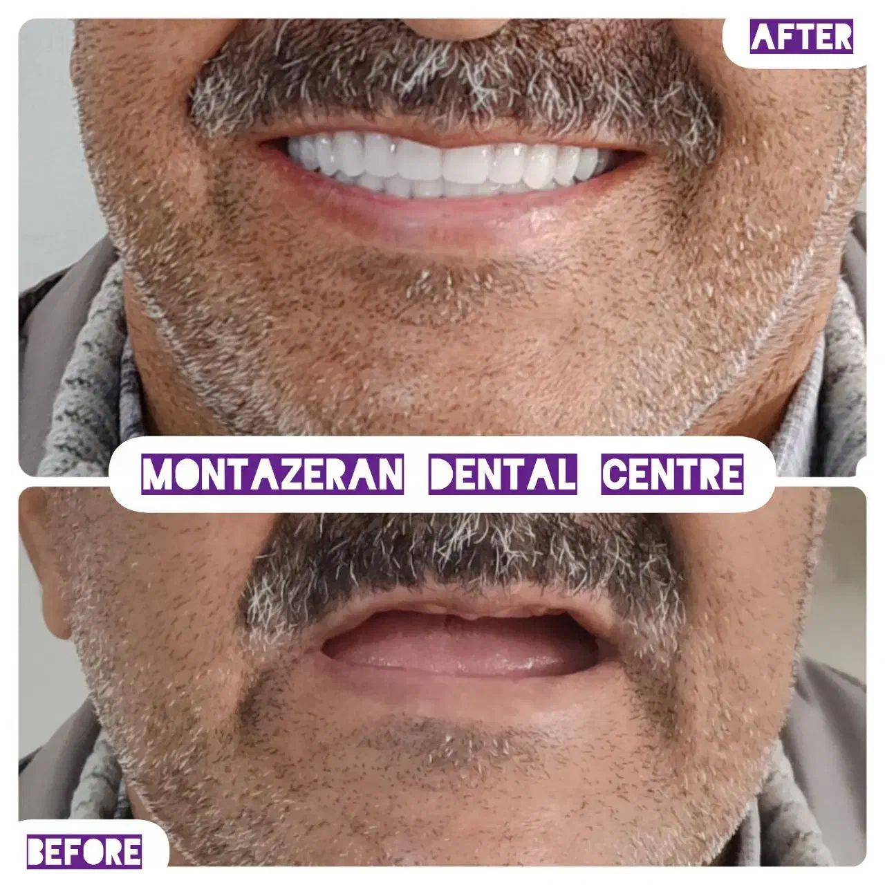 دندانسازی دندانساز دندان مصنوعی دندان باضمانت|آرایشی، بهداشتی، درمانی|مشهد, کوشش|دیوار