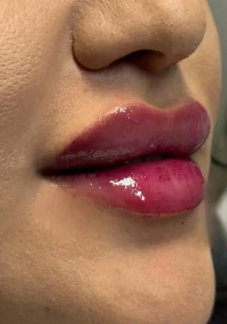 جشنواره خدمات ژل فقط 550و بوتاکس750|خدمات آرایشگری و زیبایی|فولادشهر, C3|دیوار