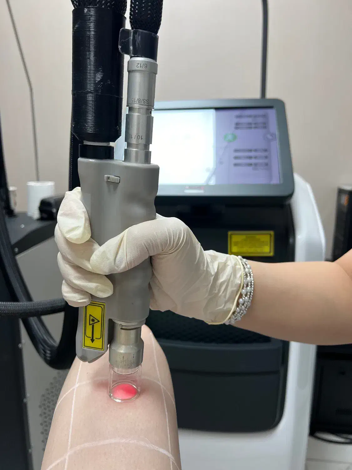 لیزر موهای زائد الکس پلاس (شاتی) بدون ژل/درمان لک|خدمات آرایشگری و زیبایی|رشت, گلسار|دیوار